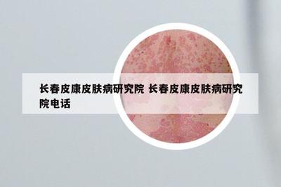 長春皮康皮膚病研究院 長春皮康皮膚病研究院電話