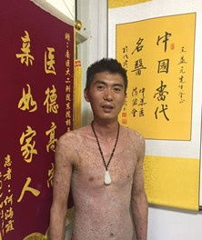 大醫精誠承國粹 濟世救人煥新顏 記中醫治療皮膚病之大國工匠王益元