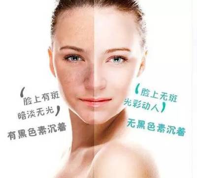 全城尋找50名免費祛斑體驗者,別做一“斑”的女人!