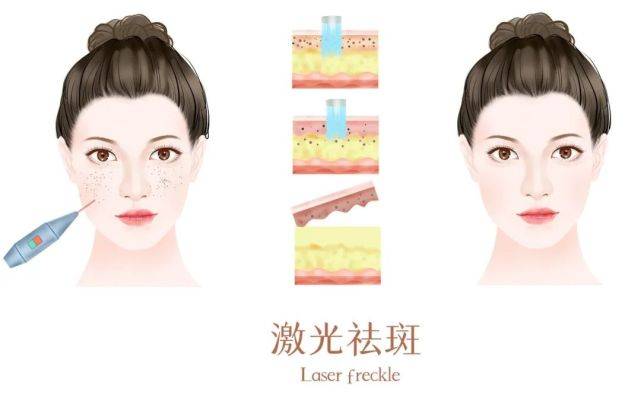 阜陽皮膚病醫院:春季科學祛斑,該如何做?