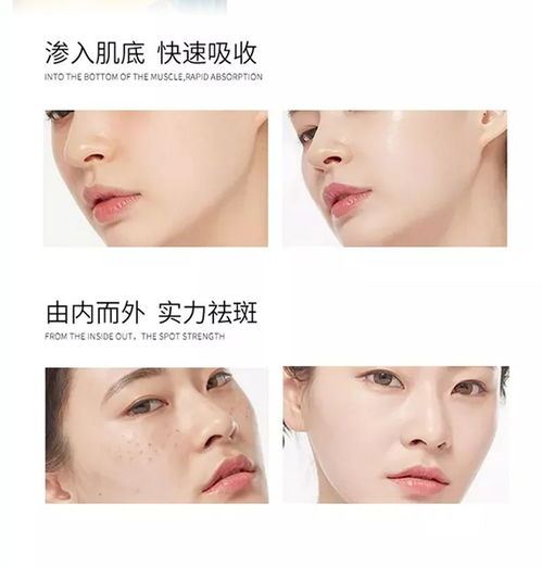 保濕祛斑霜正品黃褐斑雀斑曬斑妊娠斑老年斑各種色斑祛斑特證產品