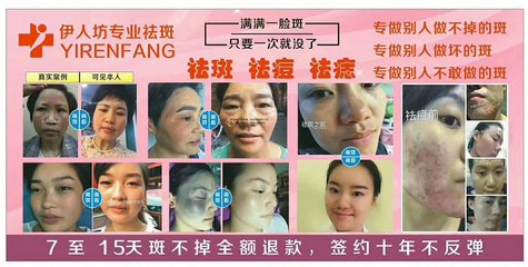 奕后美容 專業(yè)祛斑，讓肌膚重?zé)ü獠? class=