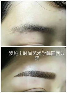 祛斑祛痘新篇章 慶祝翌芙萊專業(yè)祛斑祛痘陽(yáng)西總店盛大開(kāi)業(yè)